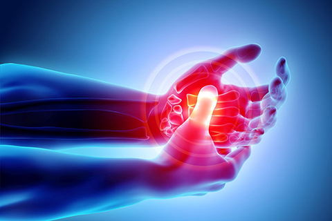 Physical Therapy Miami, FL - Arthritis Treatment