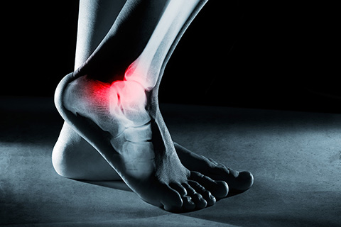 Physical Therapy Miami, FL - Foot & Ankle Pain Treatment
