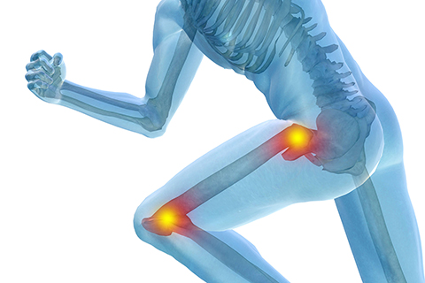 Physical Therapy Miami, FL - Hip & Knee Pain Treatment
