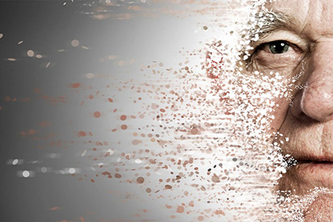 Physical Therapy Miami, FL - Vertigo Treatment